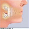 /album/wisdom-teeth/wisdome-tooth-3-jpg/